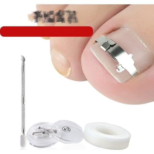 3pcs/set Stainless Ingrown Foot Care Tool Toe Nail Fixer Pedicure Recover Embed Toenail Correction Lifter Tool Kit Inset Buckle