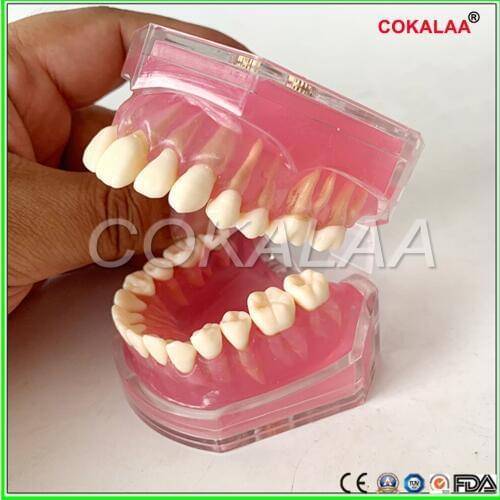 Dental Study Teaching Model Standard Model Removable Teeth Soft Gum typodont Model