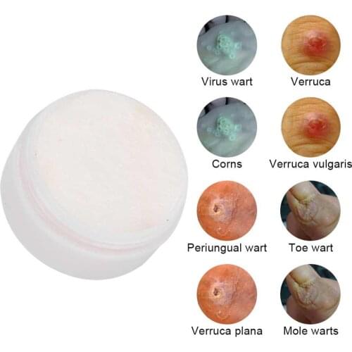 Corns Removal Cream Herbal Extract Antibacterial Removes Wart Calluses Repair Delicate Skins Plantar Nursing Portables Household