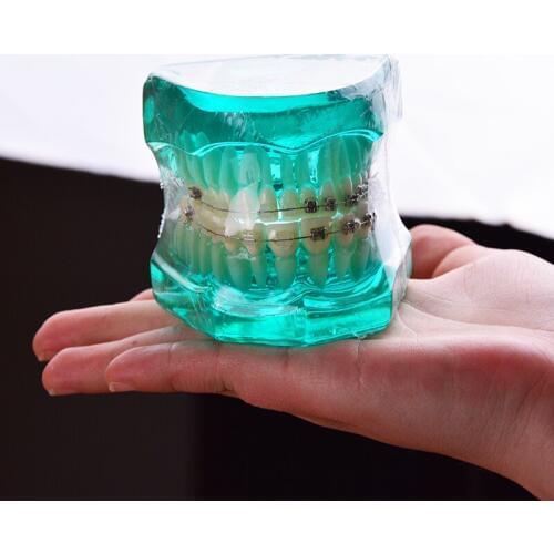 B7-02 Orthodontics Malocclusion Braces Dental Acrylic Teeth Dental Teaching Model Ortho Metal & Ceramic Bracket Teeth Model
