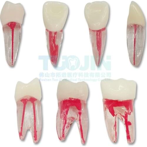 2PCS Dental Endodontic Tooth Model With Colored Root Canal And Pulp Model Dentist Tools For Student Study Practice