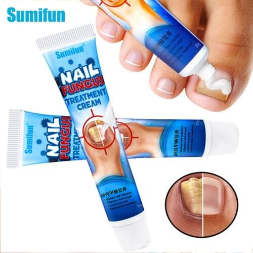 1pcs Nail Fungus Treatment Cream Onychomycosis Paronychia Herbal Antibacterial Repair Ointment Anti Fungal Feet Toe Care P1148