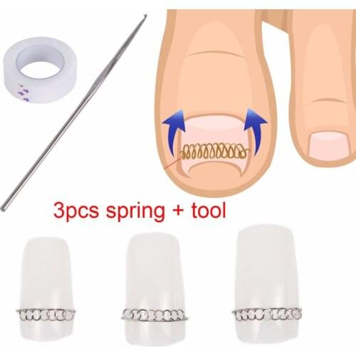 3pcs spring+tool ingrown toenails Fixer pedicure Recover Correction file spring wire corrector foot nail care tool