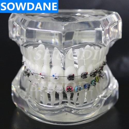 Dental Orthodontic Model 4 kinds Brackets with Ceramic Self Ligating Bracket Metal Self Ligating with tube archwire ligature