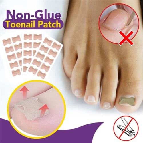 30/50pc Ingrown Toenail Corrector Sticker Paronychia Treatment Fixer Recover Corrector Pedicure Foot Toe Nail Care Tool