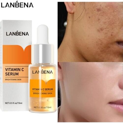 LANBENA Vitamin C Serum Whitening Dark Skin Remove Spot Freckle Melanin Brighten Pigment Dullness Moisturizing Face Care Essence