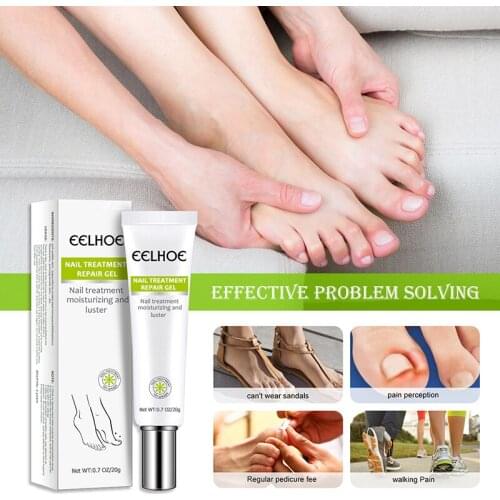 20ml Hand And Foot Nail Repair Liquid Finger Nail Toe Nail Care Serum Anti Onychomycosis Removal Gel Manicure Care Tools