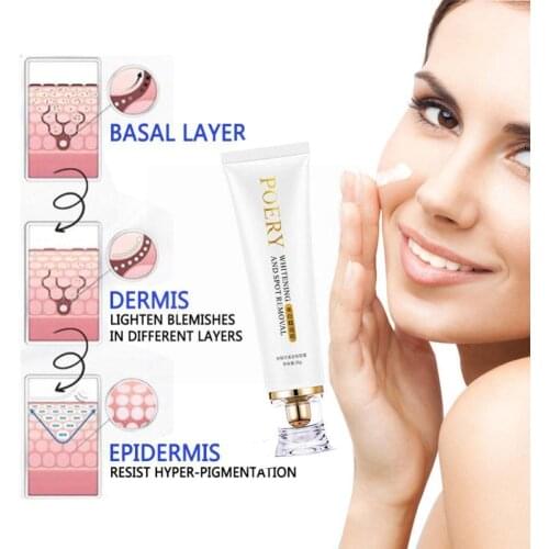 30g Effective Freckle Cream Brightening Complexion Repair Cream Moisturizing Anti Facial Aging Tone Fade Brighten Skin Care J0B6