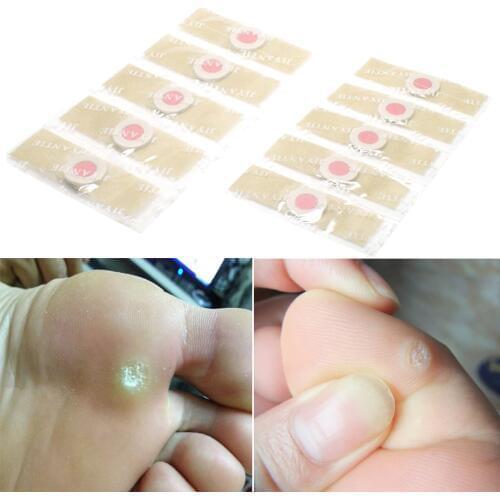 12Pcs Medical Plaster Foot Corn Removal Warts Thorn Plaster Of Calluses Callosity Detox Foot Pads Patches Curative Plaster D1360