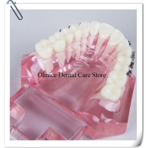 Dental Orthodontic practice model/Dental Orthodontic teeth model M3001/Full metal bracket tooth model