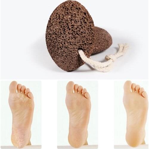 Mag Callus Remover for Dead / Hard Skin Volcanic Stone Pro Peeling