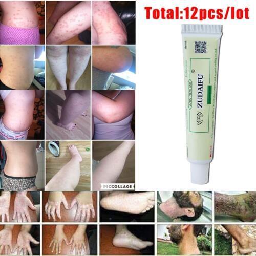 ZUDAIFU 12 pieces per lot Skin Conditions Effective Remove Psoriasis Eczema Peeling Treatment Anti Fungus without retail box