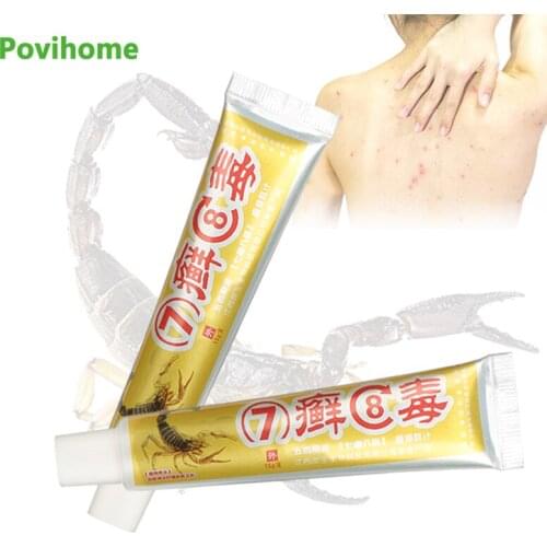 Medical Anti-itching Cream Antibacterial Antipruritic Ointment Dermatitis Eczema Psoriasis Pruritus Eczematoid Plaster Skin Care