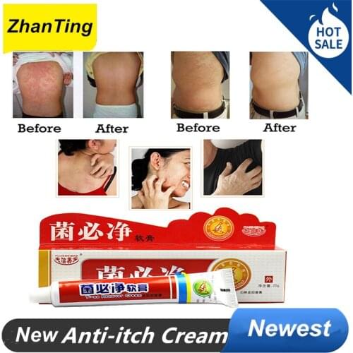 Dermatitis Men women skin Care product relieve Psoriasis Dermatitis Eczema Pruritus effect