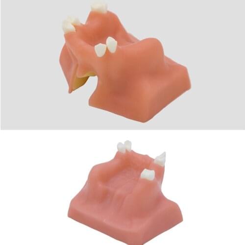 Soft supramaxillary sinus Oral implant practice Suture denture preparation Tooth model