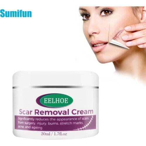 30ml Scar Removal Cream Acne Scars Gel Stretch Marks Surgical Scar Burn Pimples Repair Moisturizing Body Skin Care