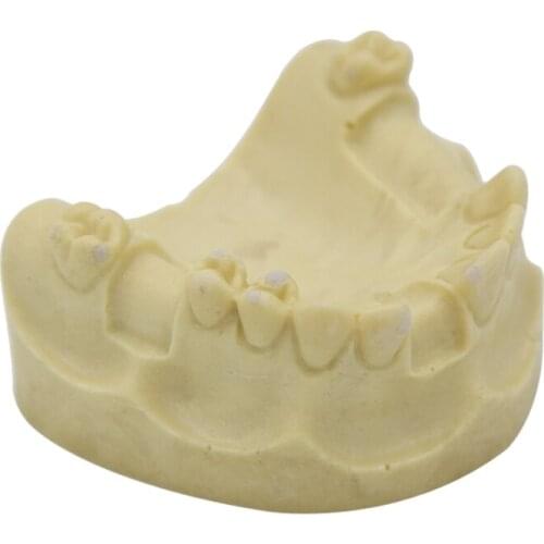 Denture tooth model Oral implant practice Dental implants with soft supramaxilla