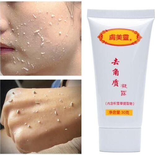 Scrub Ginger Exfoliating Gel Cleanser Nourishing Cleanser Moisturizing Face Wash Skin Care Anti-spot Gel
