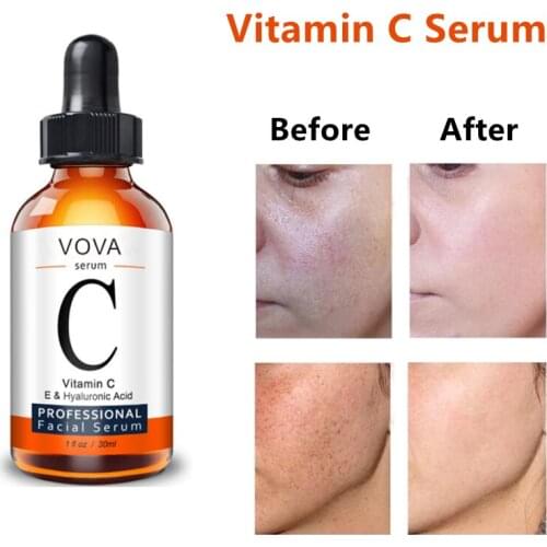 VC Liquid Serum Anti-aging Whitening Face Serum Anti Wrinkles Acne Vitamin C Essences Oil Facial Moisturizing Skin Care Cosmetic