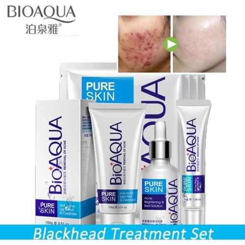 BIOAQUA Anti Acne Shrink Pores Whitening Treatment Blackhead Scars Anti Acne Removal Gel Moisturizing Scar Face Care Set 4 pcs