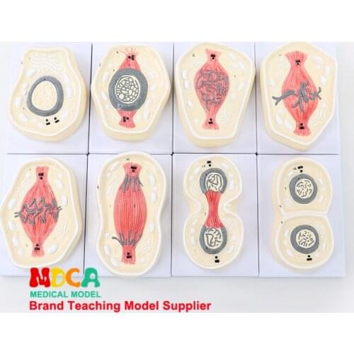 Cell Mitosis Indirect Division Chromosome Model Medical Teaching