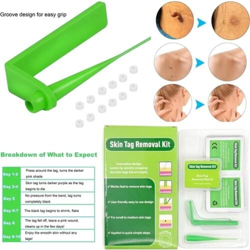 Home Use Micro Skin Tag Mole Wart Remover Kit Non Toxic Green Micro Band Skin Tag Removal Kit For Small Medium Mole Wart Adult