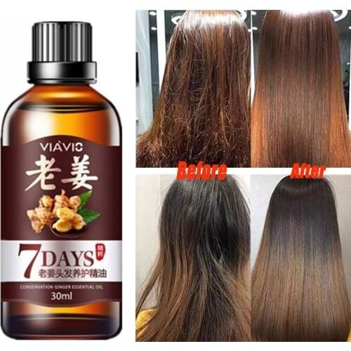30ml Ginger Hair Growth Natural Effective Essential Oil Fast Growth Germinal Serum Hair Loss Treatement Regrowth Hair