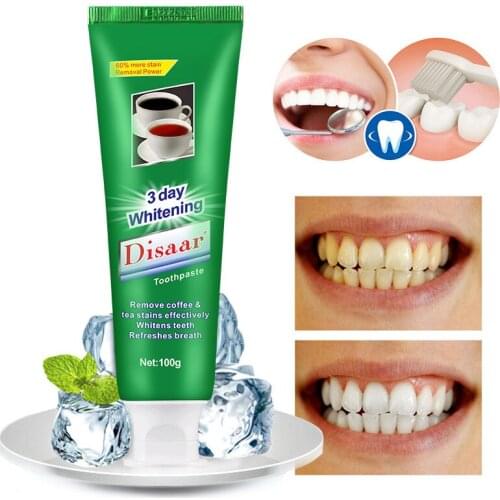 Remove Tea Stain, Coffee Stain Toothpaste, Whitening Teeth and Oral Freshening Fresh Mint Flavor Dental Oral Care Tool