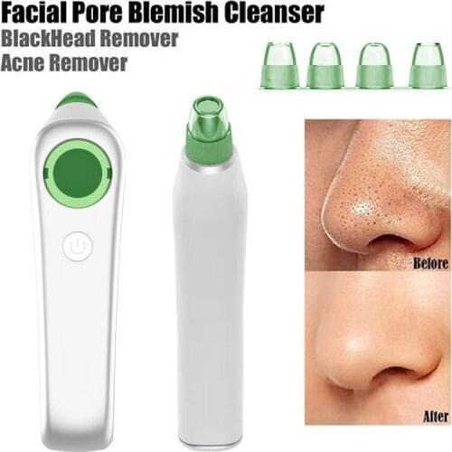 Electric Acne Remover Point Noir Blackhead Vacuum Extractor Tool Black Spots Pore Cleaner Skin Care Face Deep Cleansing Machine