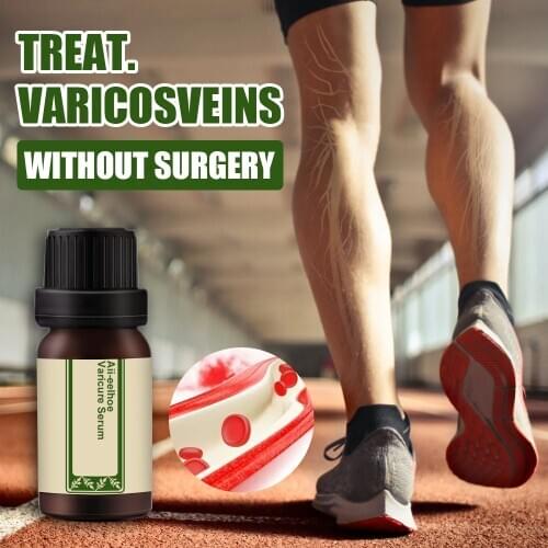 All-Natural Vari-Cure Serum All-eelhoe Varicose Vein Treatment for Treatment Legs Care Health99