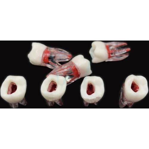 1pcs Dental Tooth Model Dental Medullary Root Canal RCT Practice Pulp Cavity Clear Resin 1:1 Teaching Teeth Model Dentist Tools