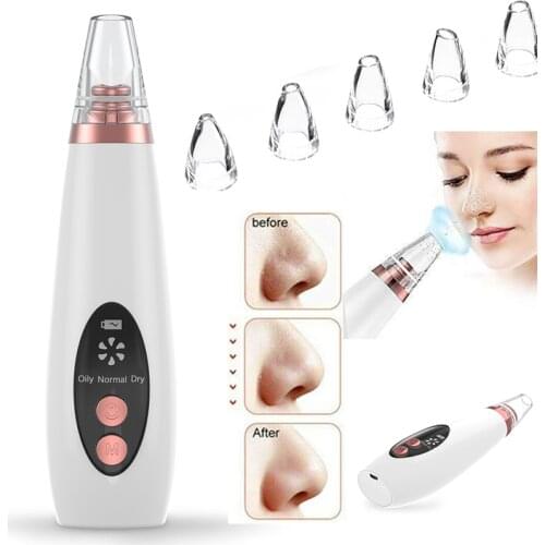Facial Blackhead Remover Electric Pore Cleaner Blackhead Black Point Vacuum Cleaner Tool Black Spots Pore Cleaner Machine
