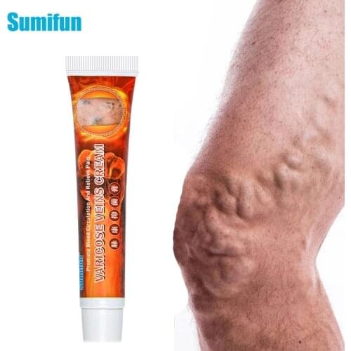Varicose Veins Ointmnet Vasculitis Phlebitis Spider Cream Varicosity Angiitis Removal Herbal Medical Plaster 20g