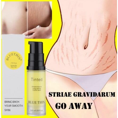 Stretch Mark Reducer Lightening Pigment Remove Stretch Marks Acne Scar Fat Scar Strie Skin Care Essential Cream