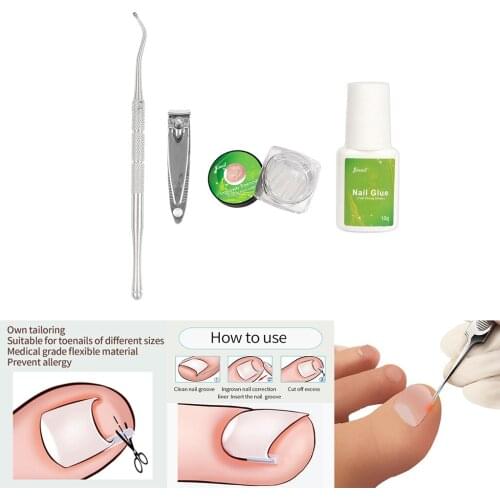 Professional Ingrown Toenail Tools Toe Nail File Patch Manicure Foot Care