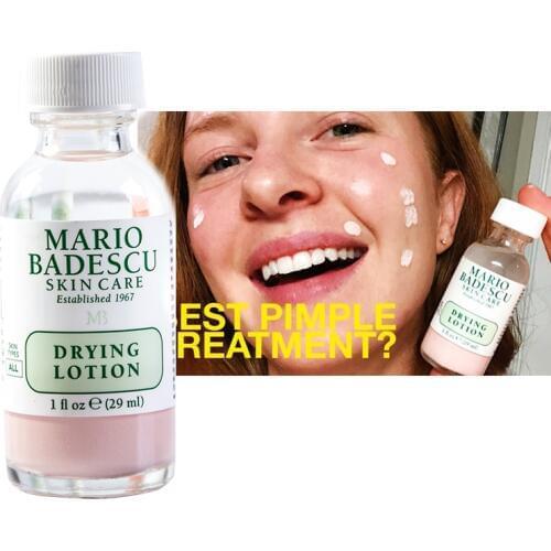 Acne SOS Mario Badescu Drying Lotion 29ml 1oz Effective Acne Spot Treatment