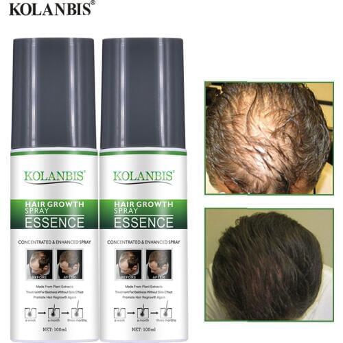 2 bottle Permanent Hair Growth Tonic Fast Thickener Hair Loss Treatment Serum Anti Thinning Baldness Rebuild Chinese Medicine