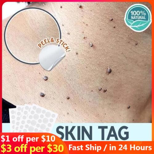 36pcs Skin Tag Remover Warts Remover Patch Wart Treatment Cream Herbal Extract Foot Corn Plaster Acne Warts Ointment