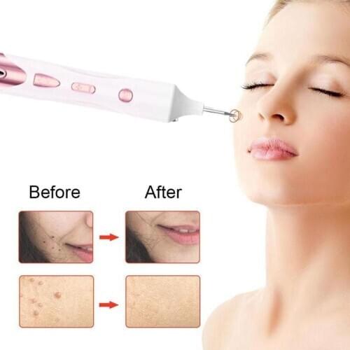 Plasma Pen Mole Tattoo Freckle Wart Tag Removal Pens Dark Spot Remover Skin Care Tools Women Beauty Instrument