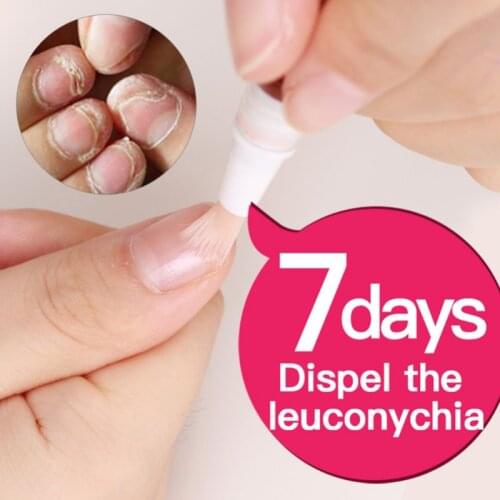 Y1UF 3ml Fungal Nail Pen Effective Onychomycosis Paronychia Fungus Infection Repair Solution Gel Toenail Treatment Nutrient