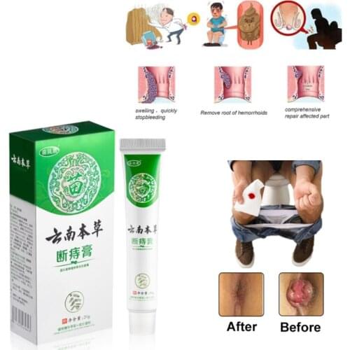 Hemorrhoids Treatment Cream Mixed External & Internal Anal Fissure Pain Relief Chinese Herbal Ointment Health Care 20g