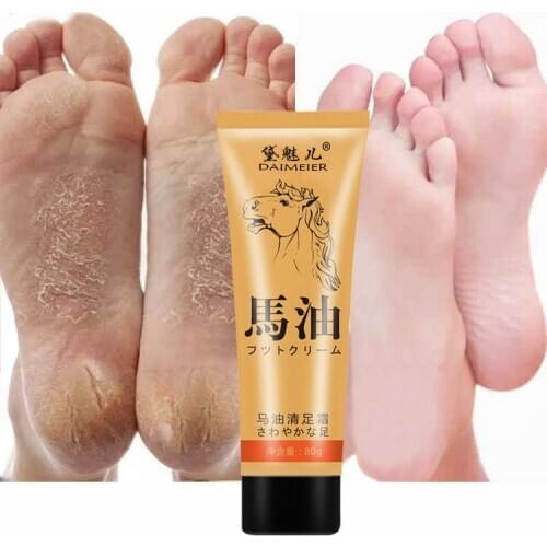 Horse oil cream heel dry crack chilblain crack hand and foot dry crack peeling repair cream hand cream for men and women