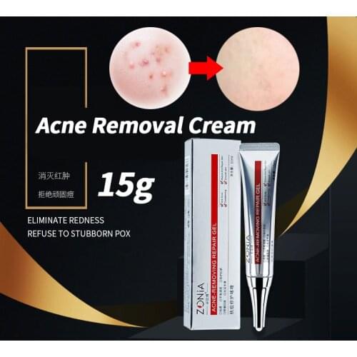 Effective Acne Removal Cream Acne Treatment Fade Acne Spots Oil Control Shrink Pores Whitening Moisturizing Acne Cream Skin Care