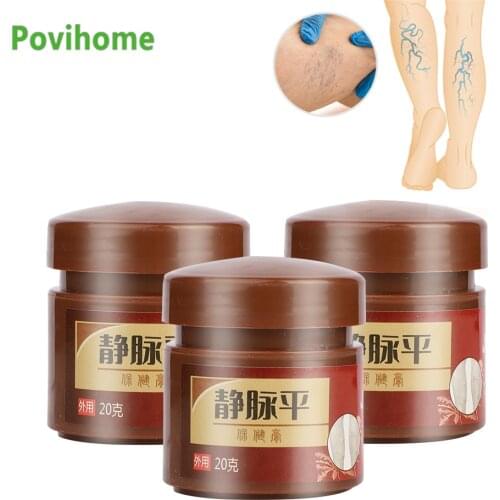20g Varicose Veins Treatment Cream Vasculitis Phlebitis Spider Pain Relief Ointment Vascular Massage Medical Plaster Health Care