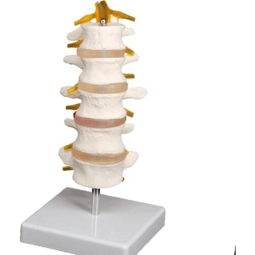 Life Size Five Section Lumbar Spine Skeleton Model with Stand Medical Teaching Training Aid