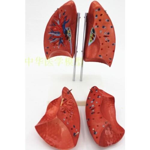 Human lung anatomical model lung leaf model respiratory system lung model lung leaflet