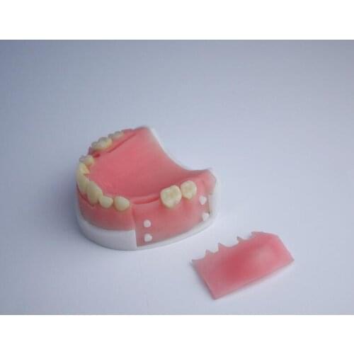 Simulated oral suture model Periodontal suture exercises Teaching and training tool for preparing tooth cysts