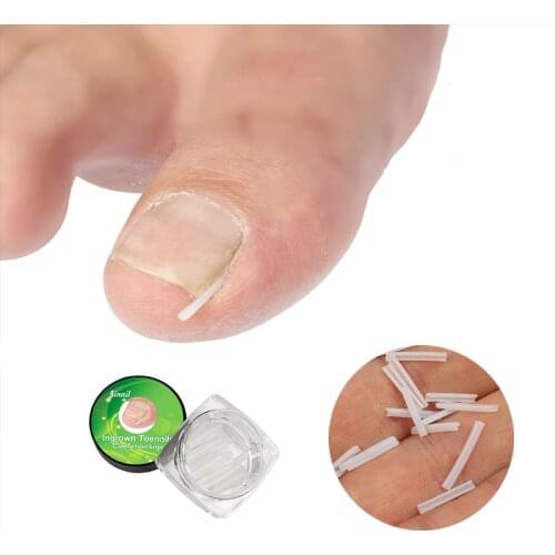 10PCS Silicone Ingrown Nail Pad Relief Pain Paronychia Correction Tool Ortho Nail Filling Nail Groove Pad Ingrown Nail Corrector