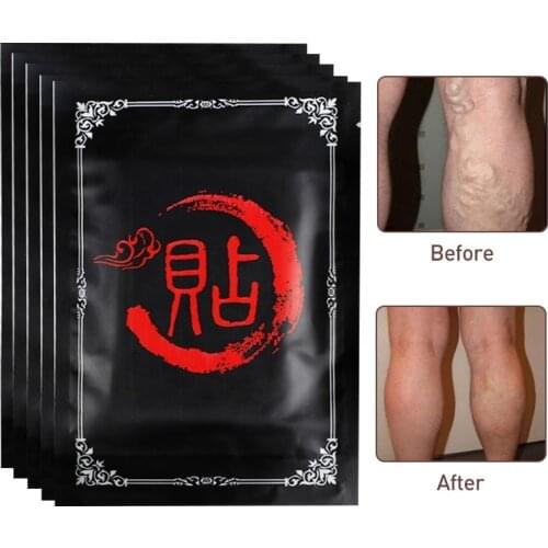 1 pc Varicose Veins Plaster Vasculitis Phlebitis Spider Leg Skin Care Treatment Herb Medical Patch Angiitis Removal Patch