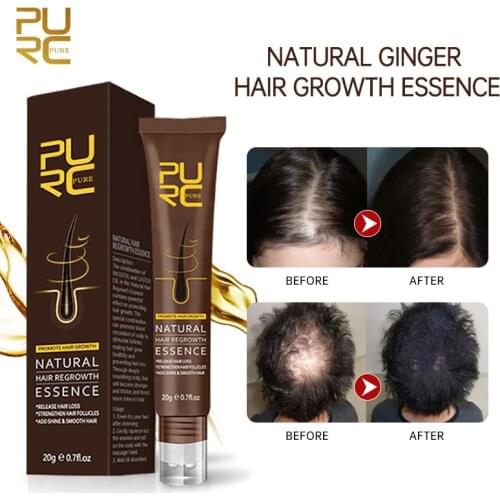 PURC Fast Hair Growth Oil Hair Treatment Ginger Extract Growing Hair Products for Hair Care for man and women Prevent Hair Loss